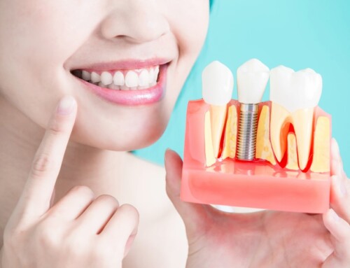 Dealing With Dental Implant Pressure and Pain – Tips for a Comfortable Recovery